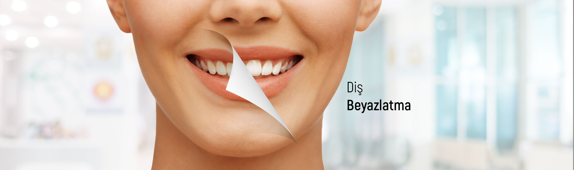 Diş Beyazlatma