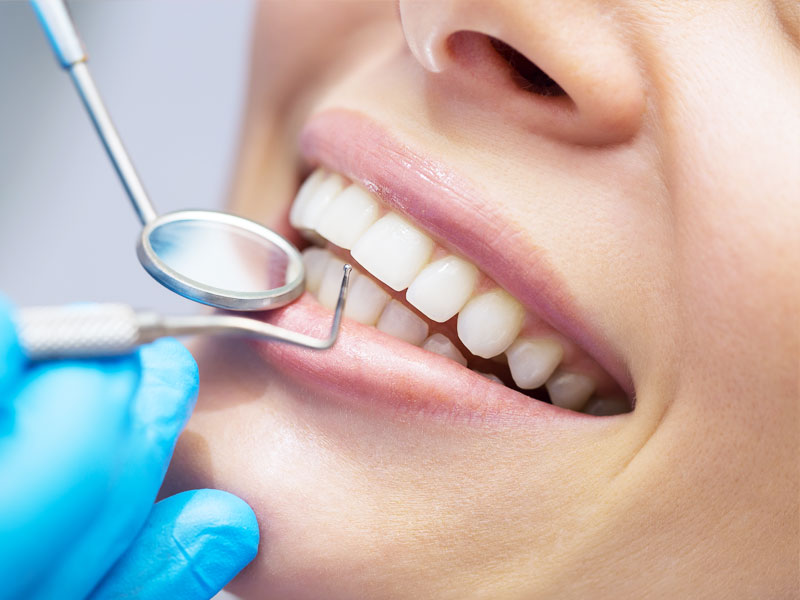 Dentephesus Diş Check-Up