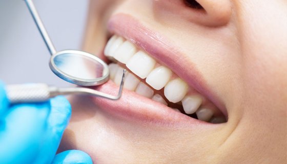 Dentephesus Diş Check-Up